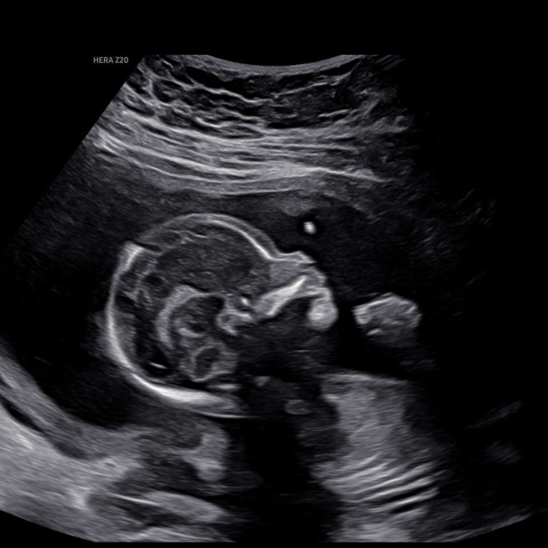 Photo shared by Jada for their Babylist baby registry.