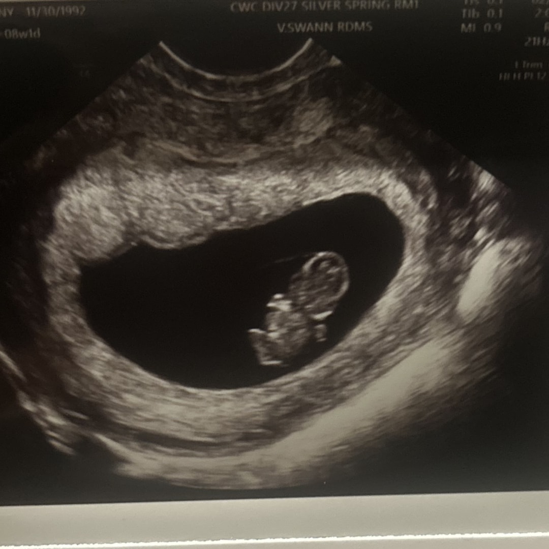 Photo shared by Cathony for their Babylist baby registry.