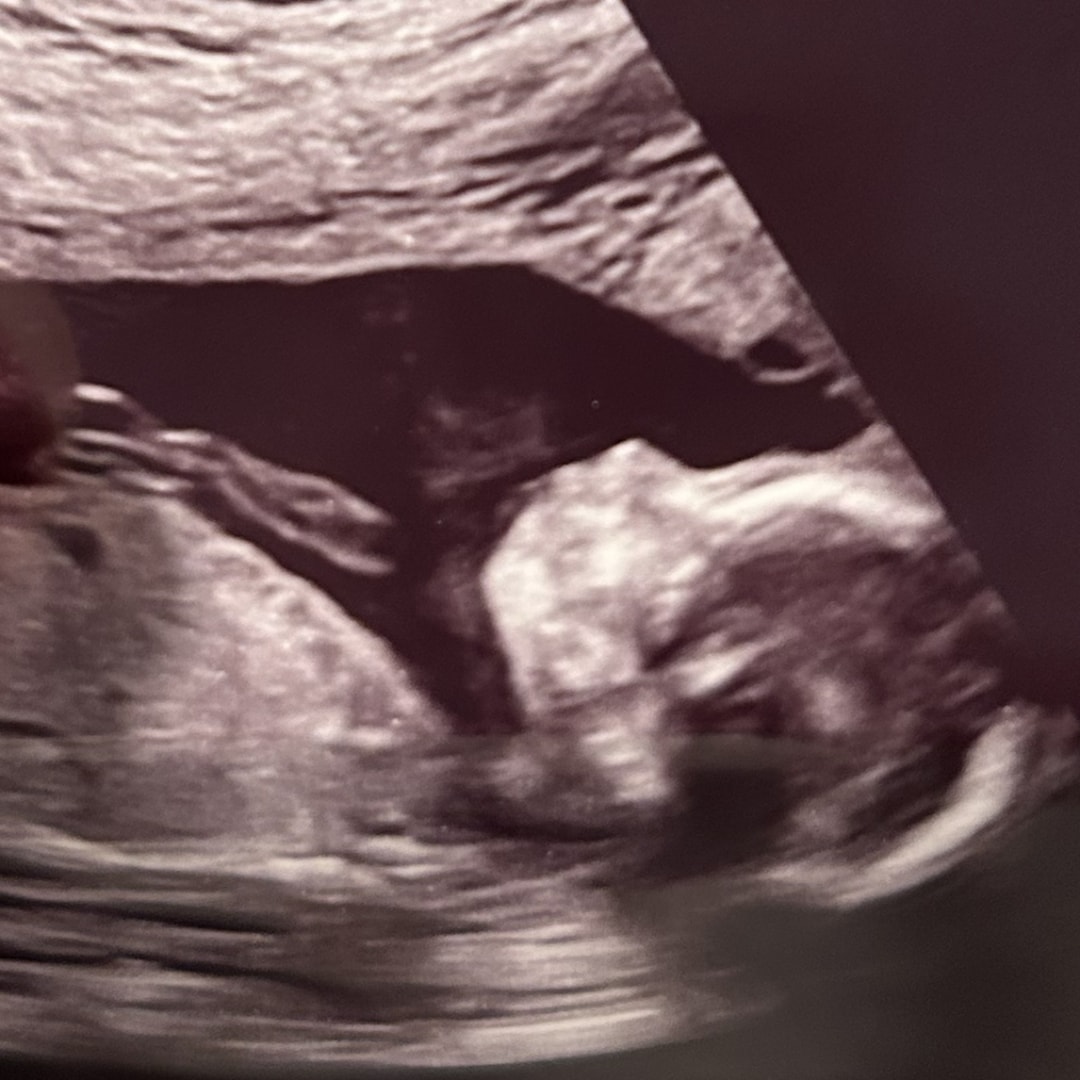 Photo shared by Sammie for their Babylist baby registry.