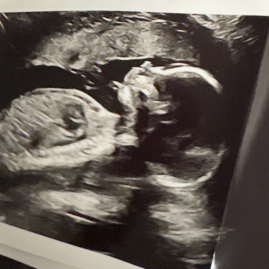 Photo shared by Alijah for their Babylist baby registry.
