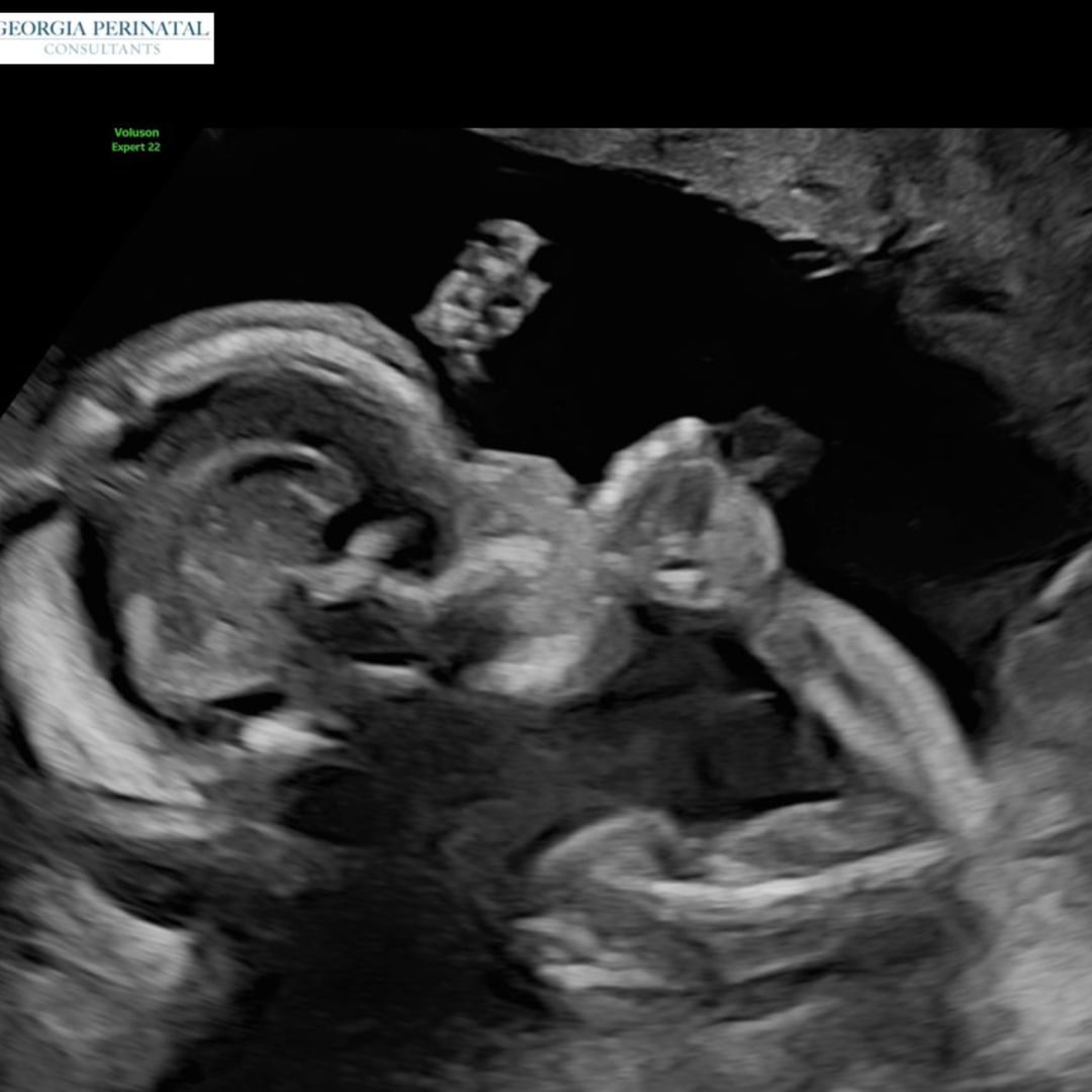 Photo shared by Kris for their Babylist baby registry.