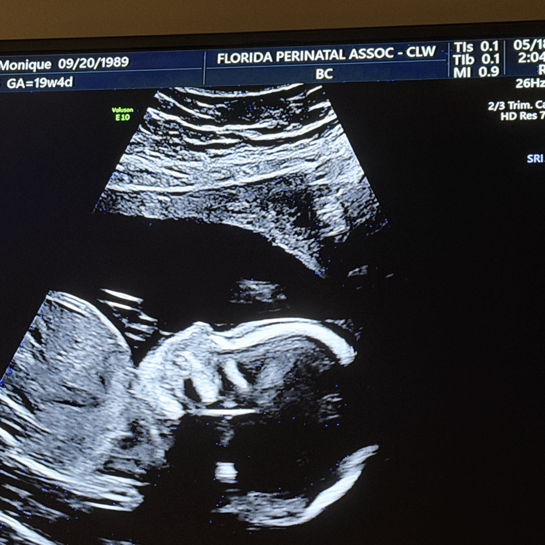 Photo shared by Monique for their Babylist baby registry.