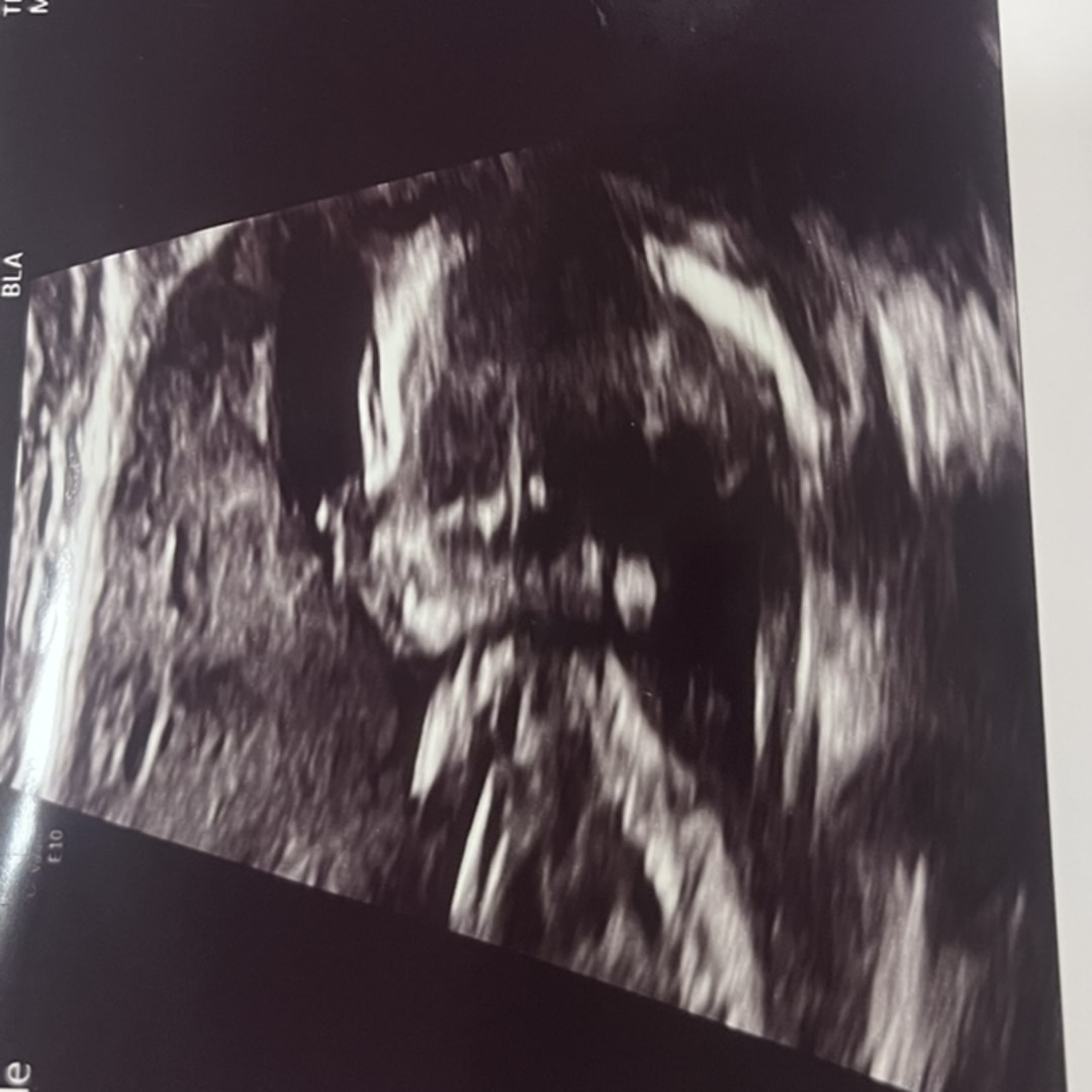 Photo shared by Anna for their Babylist baby registry.