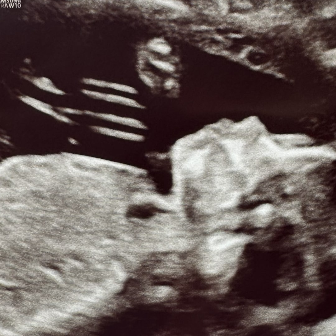 Photo shared by Hannah for their Babylist baby registry.