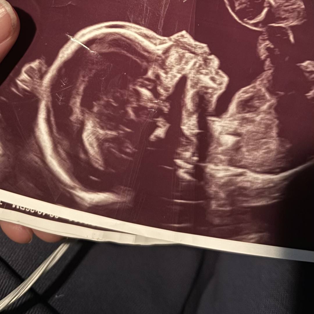 Photo shared by Jade for their Babylist baby registry.