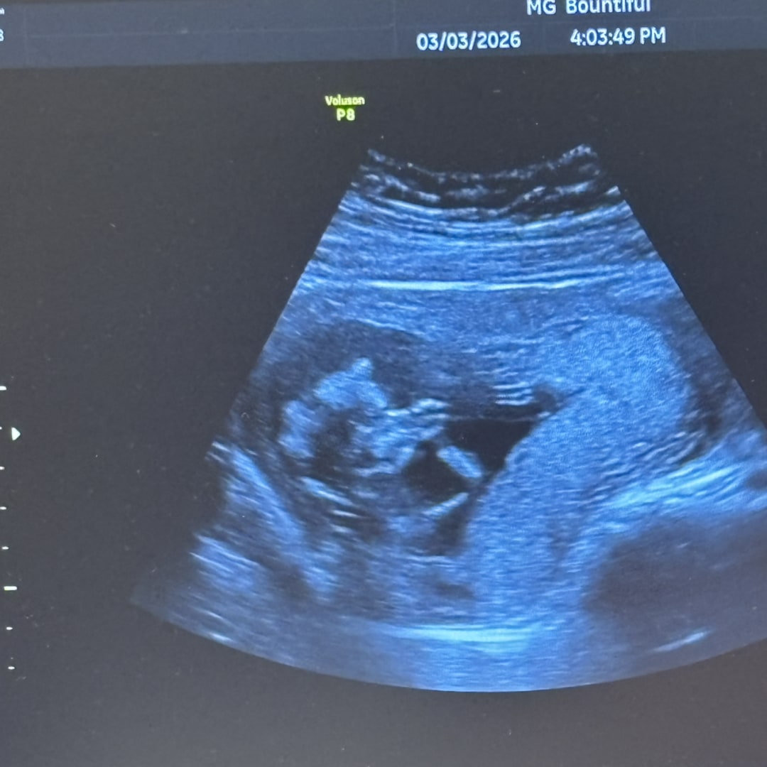 Photo shared by Jacie for their Babylist baby registry.