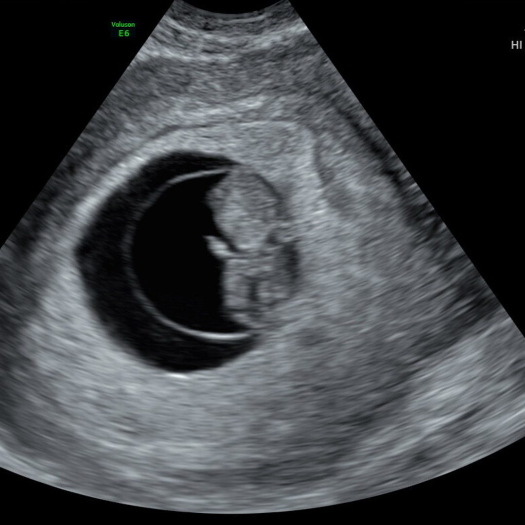 Photo shared by Lily for their Babylist baby registry.