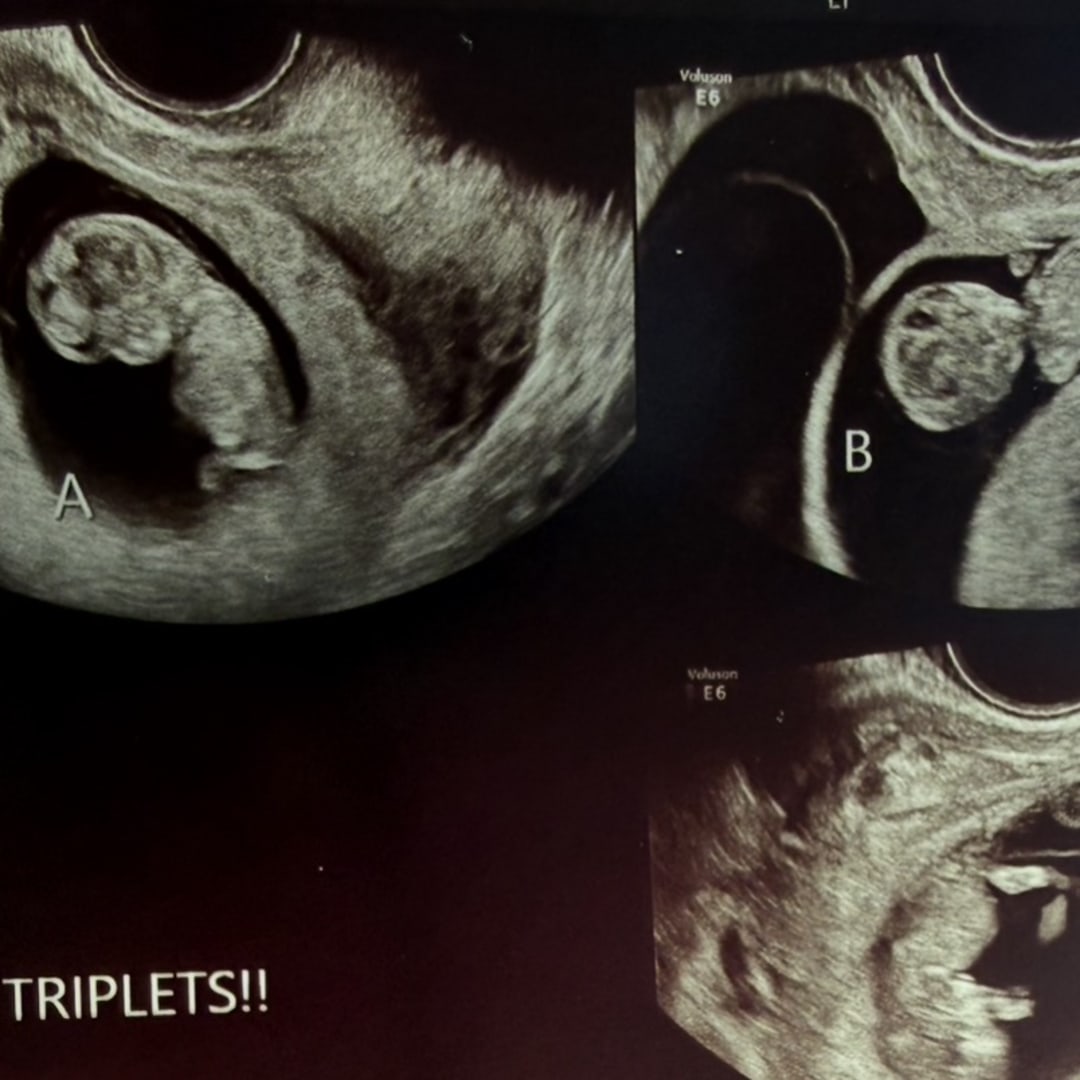 Photo shared by Meagan for their Babylist baby registry.