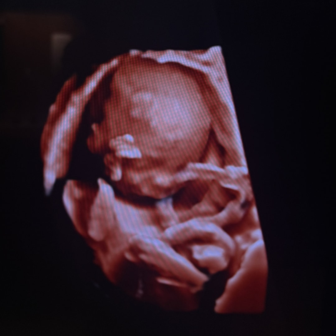 Photo shared by Allison for their Babylist baby registry.