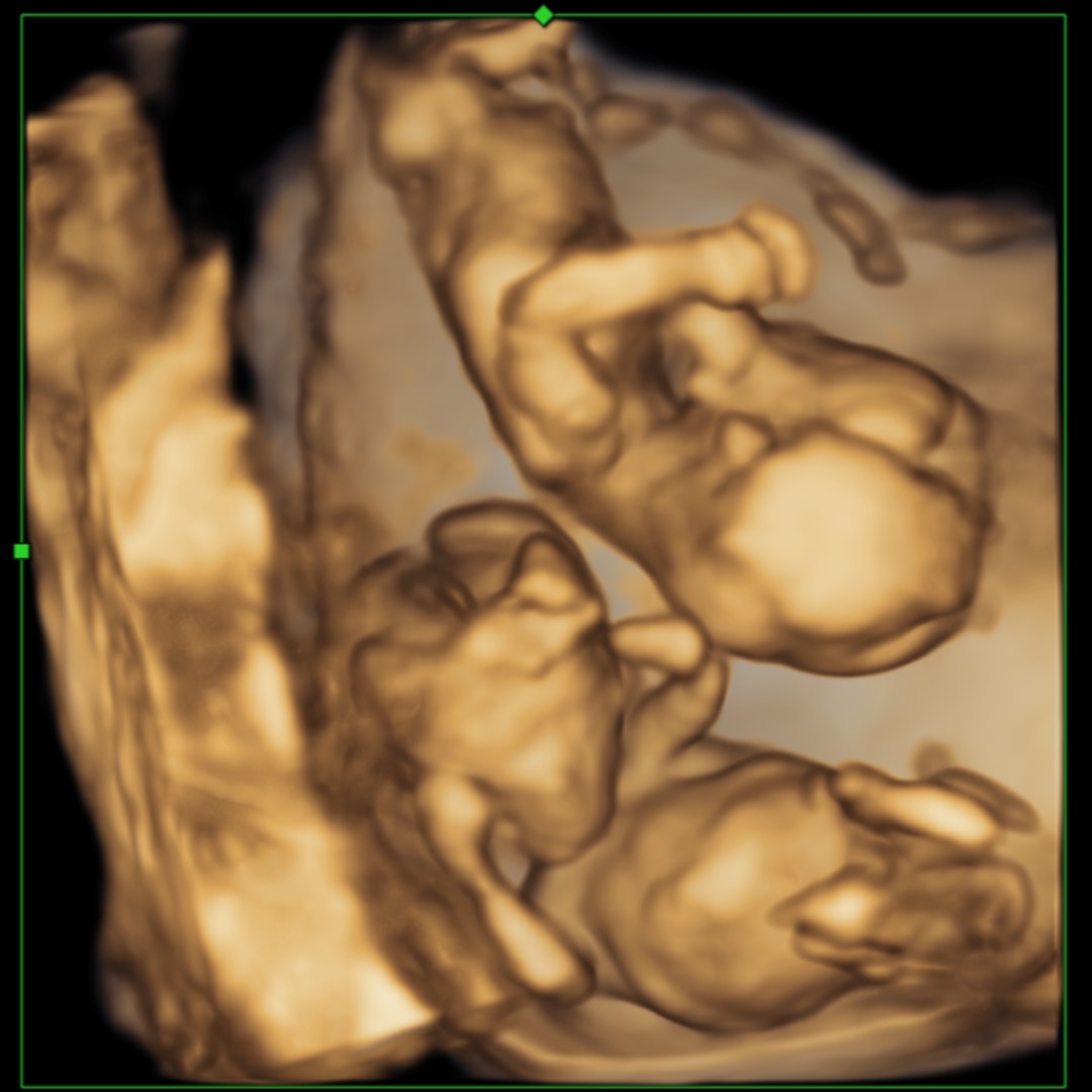 Photo shared by Abigail for their Babylist baby registry.