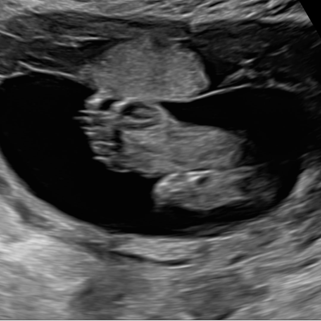 Photo shared by Jordan for their Babylist baby registry.
