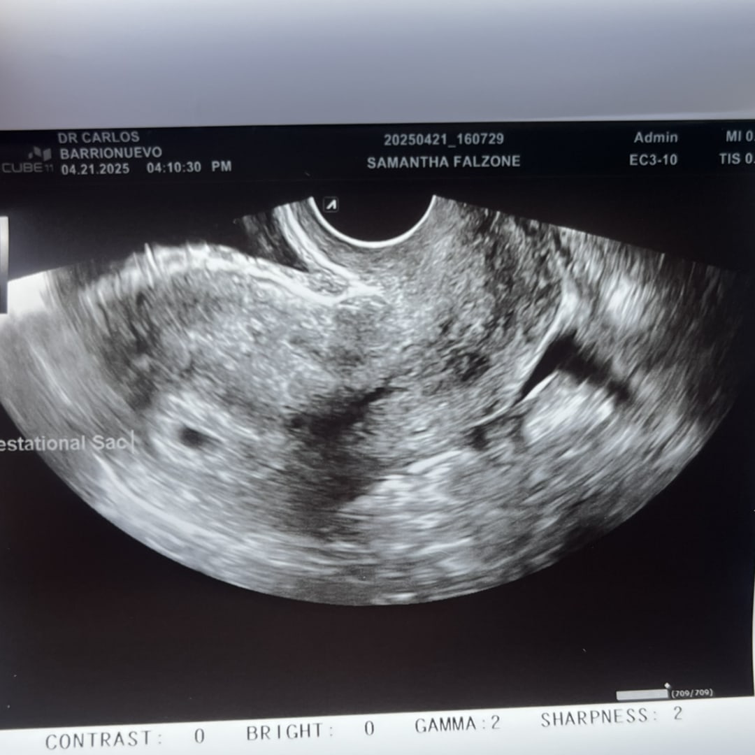 Photo shared by Samantha for their Babylist baby registry.