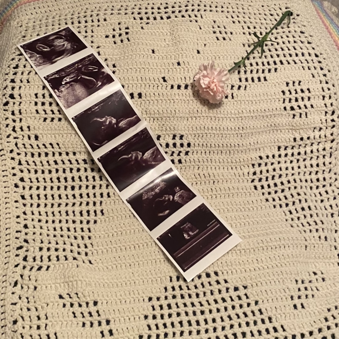 Photo shared by Abby for their Babylist baby registry.