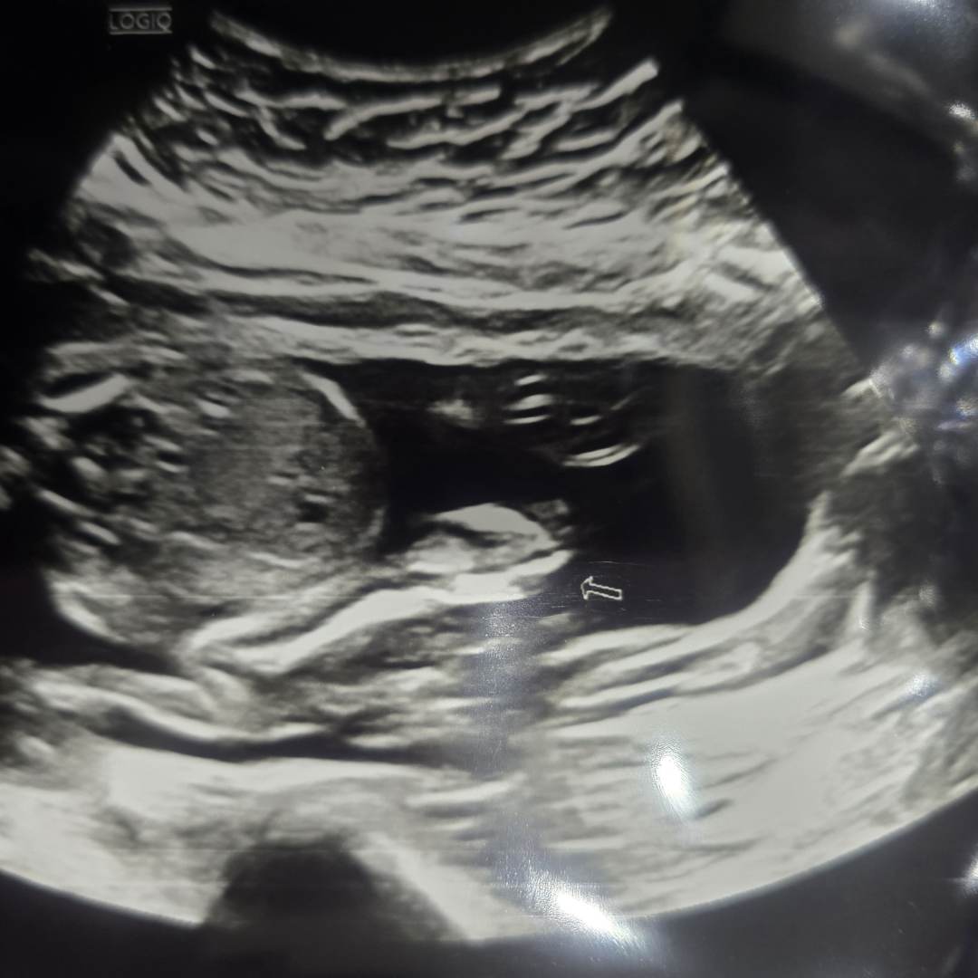 Photo shared by Chayanne for their Babylist baby registry.