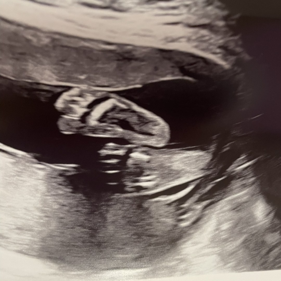 Photo shared by Lakyn for their Babylist baby registry.