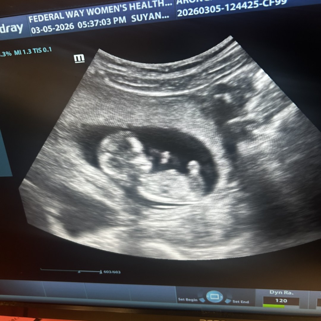 Photo shared by Sydney for their Babylist baby registry.