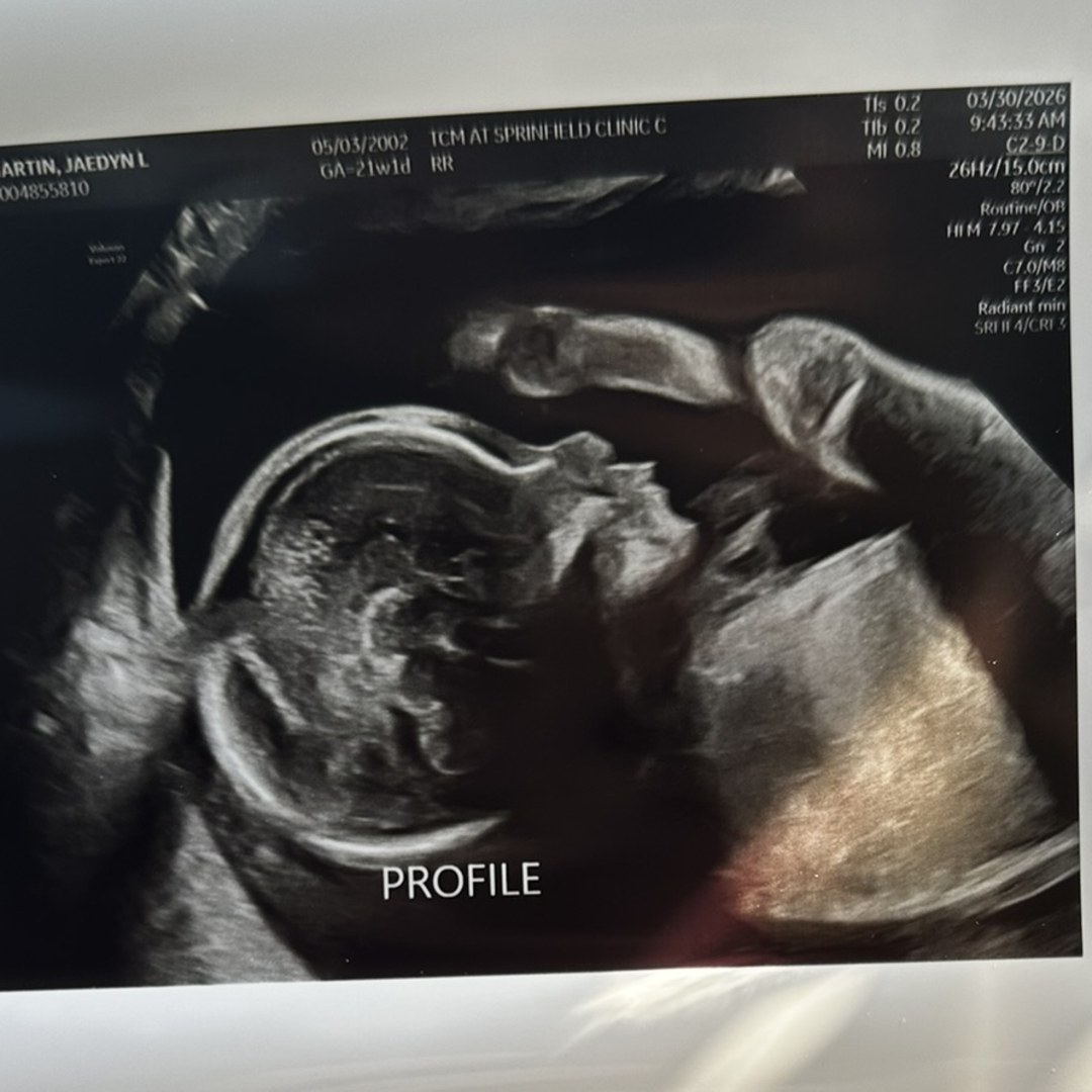 Photo shared by Jaedyn for their Babylist baby registry.