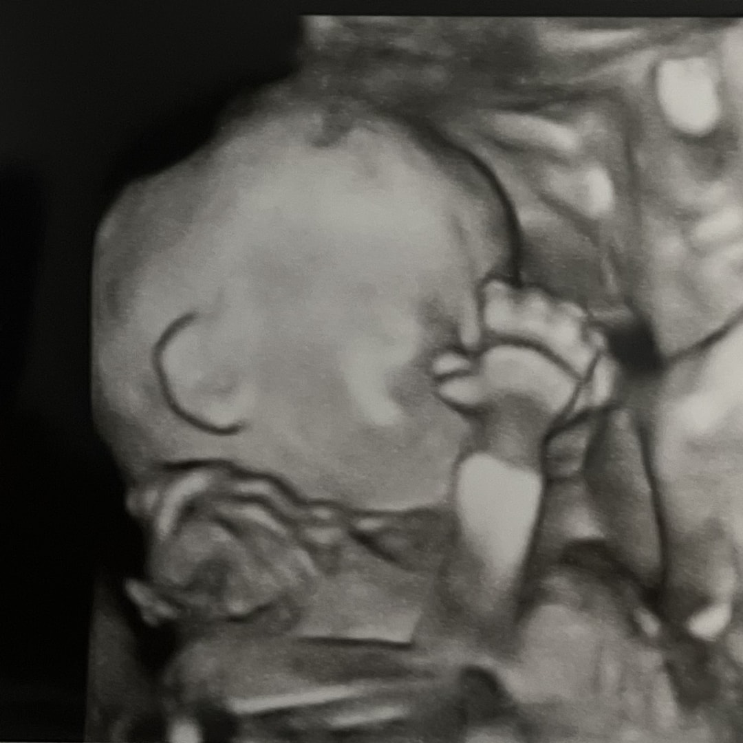 Photo shared by Mary Beth for their Babylist baby registry.