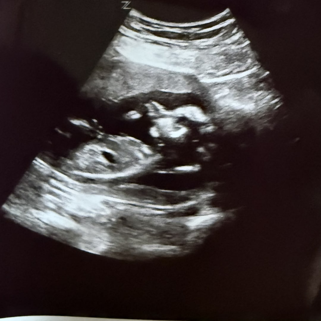 Photo shared by Courtney for their Babylist baby registry.
