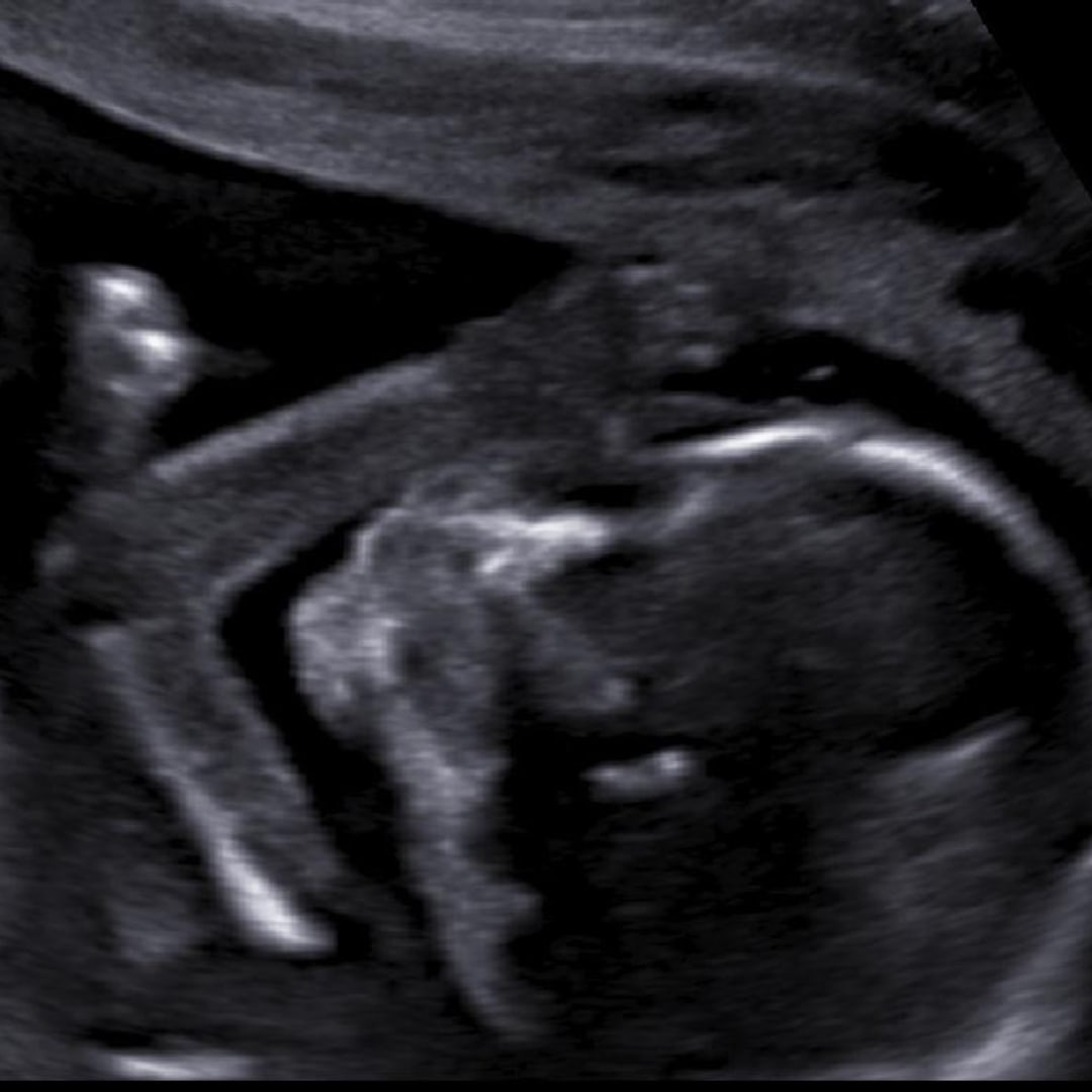 Photo shared by Brianna for their Babylist baby registry.