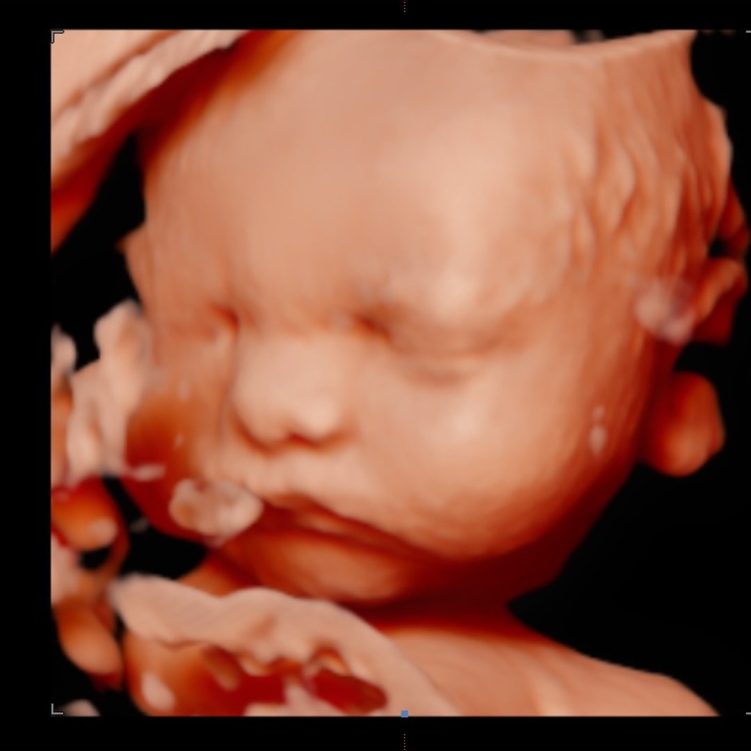 Photo shared by Adrienna for their Babylist baby registry.