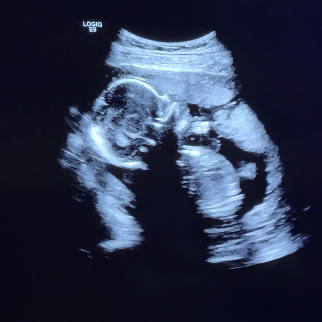 Photo shared by Chloe for their Babylist baby registry.