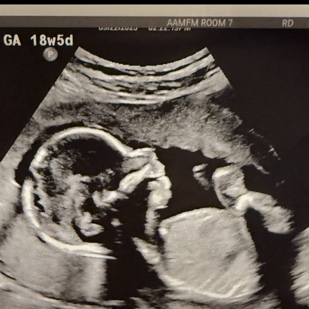 Photo shared by Lainee for their Babylist baby registry.