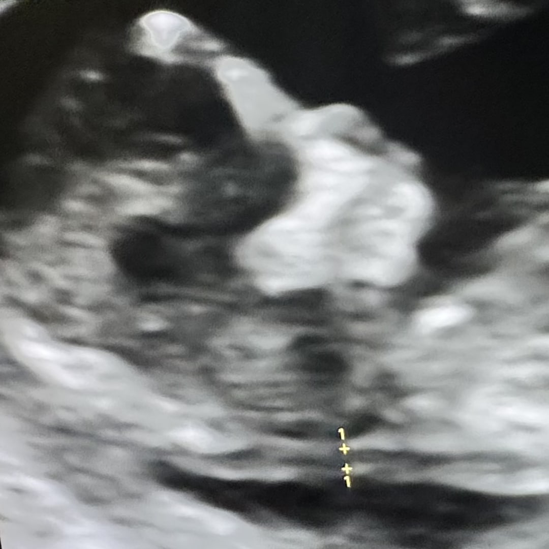 Photo shared by Rhiannon for their Babylist baby registry.