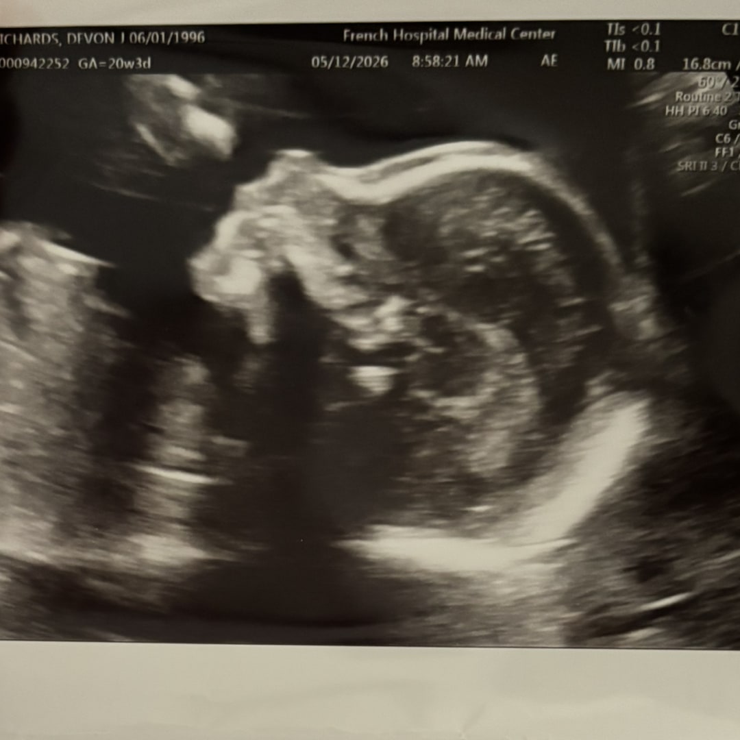 Photo shared by Devon for their Babylist baby registry.