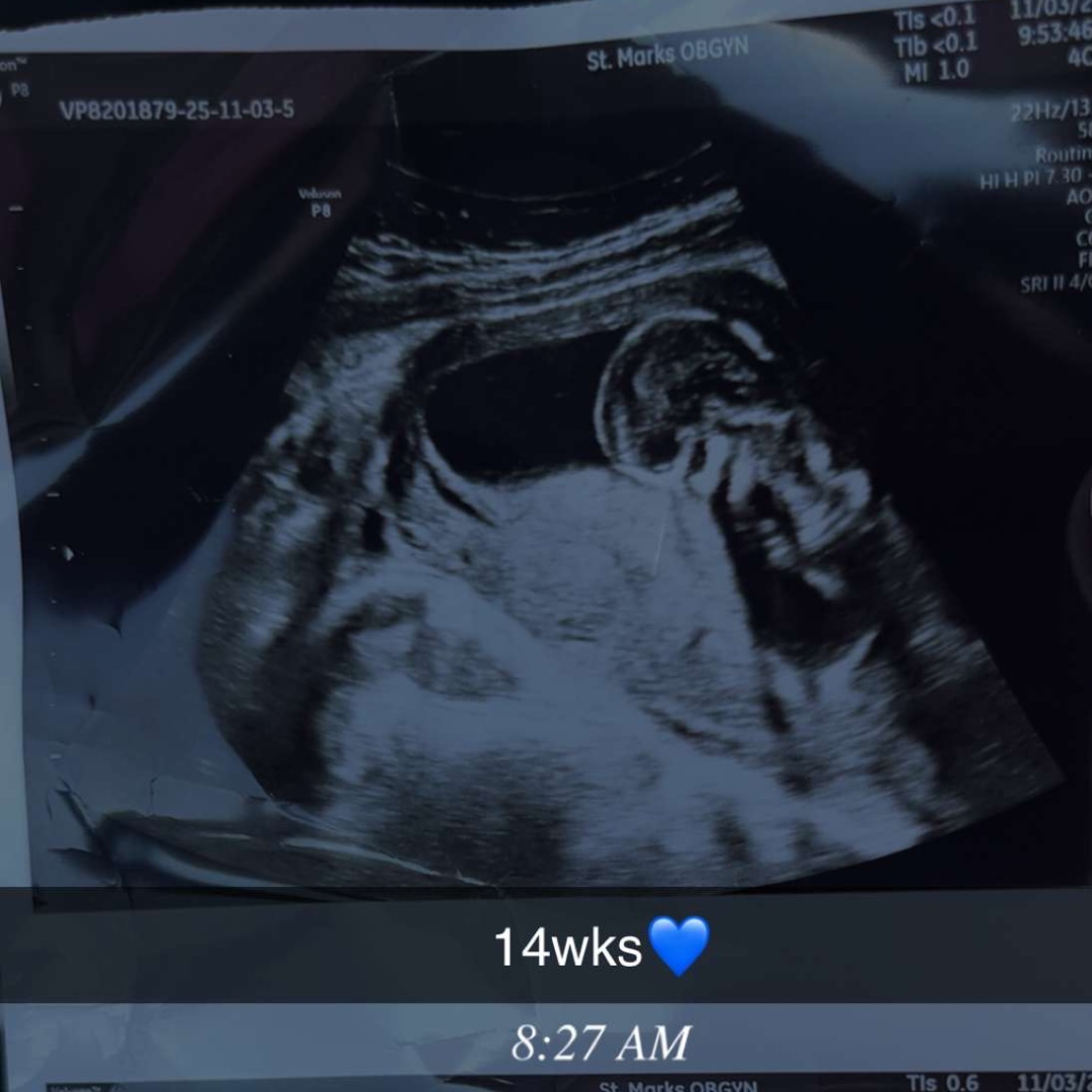 Photo shared by Dustie for their Babylist baby registry.