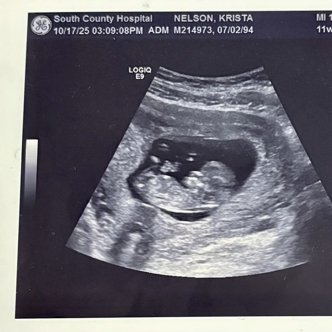 Photo shared by Krista for their Babylist baby registry.