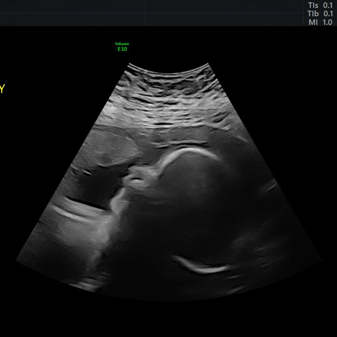 Photo shared by Kailey for their Babylist baby registry.