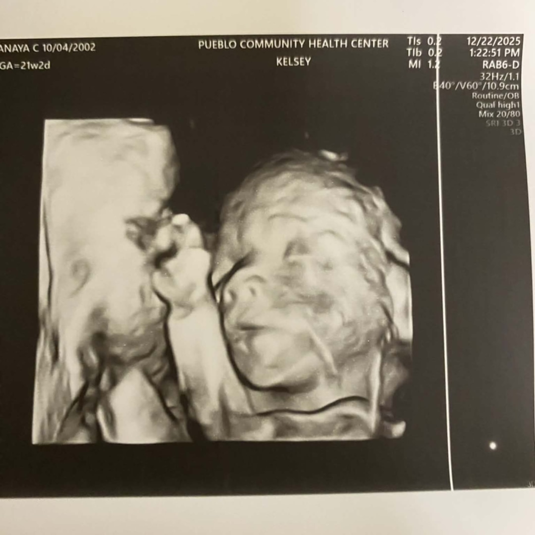 Photo shared by Anaya for their Babylist baby registry.