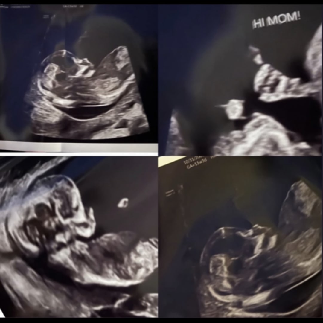 Photo shared by Kyana for their Babylist baby registry.