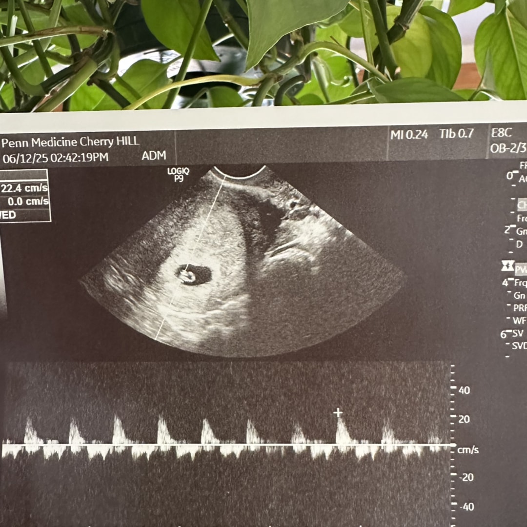 Photo shared by Caroline for their Babylist baby registry.