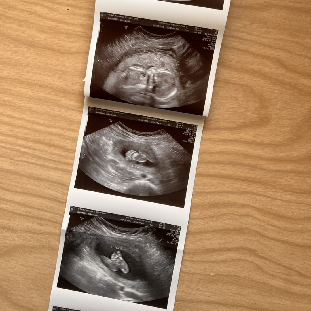 Photo shared by Francesca for their Babylist baby registry.
