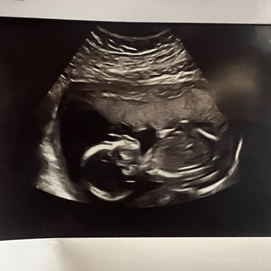 Photo shared by Alexia for their Babylist baby registry.