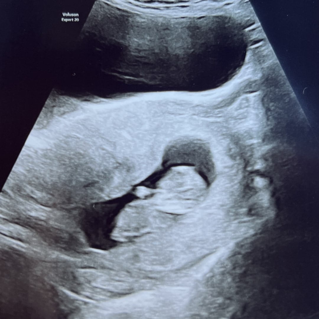 Photo shared by Trevor for their Babylist baby registry.