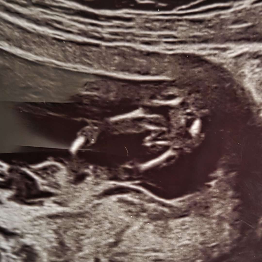 Photo shared by Heidi for their Babylist baby registry.