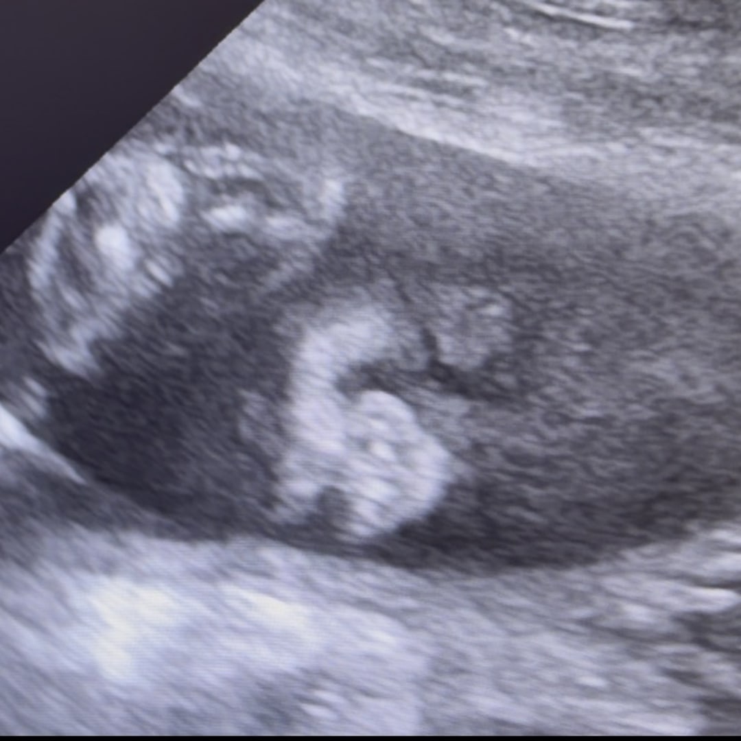 Photo shared by Brandi for their Babylist baby registry.