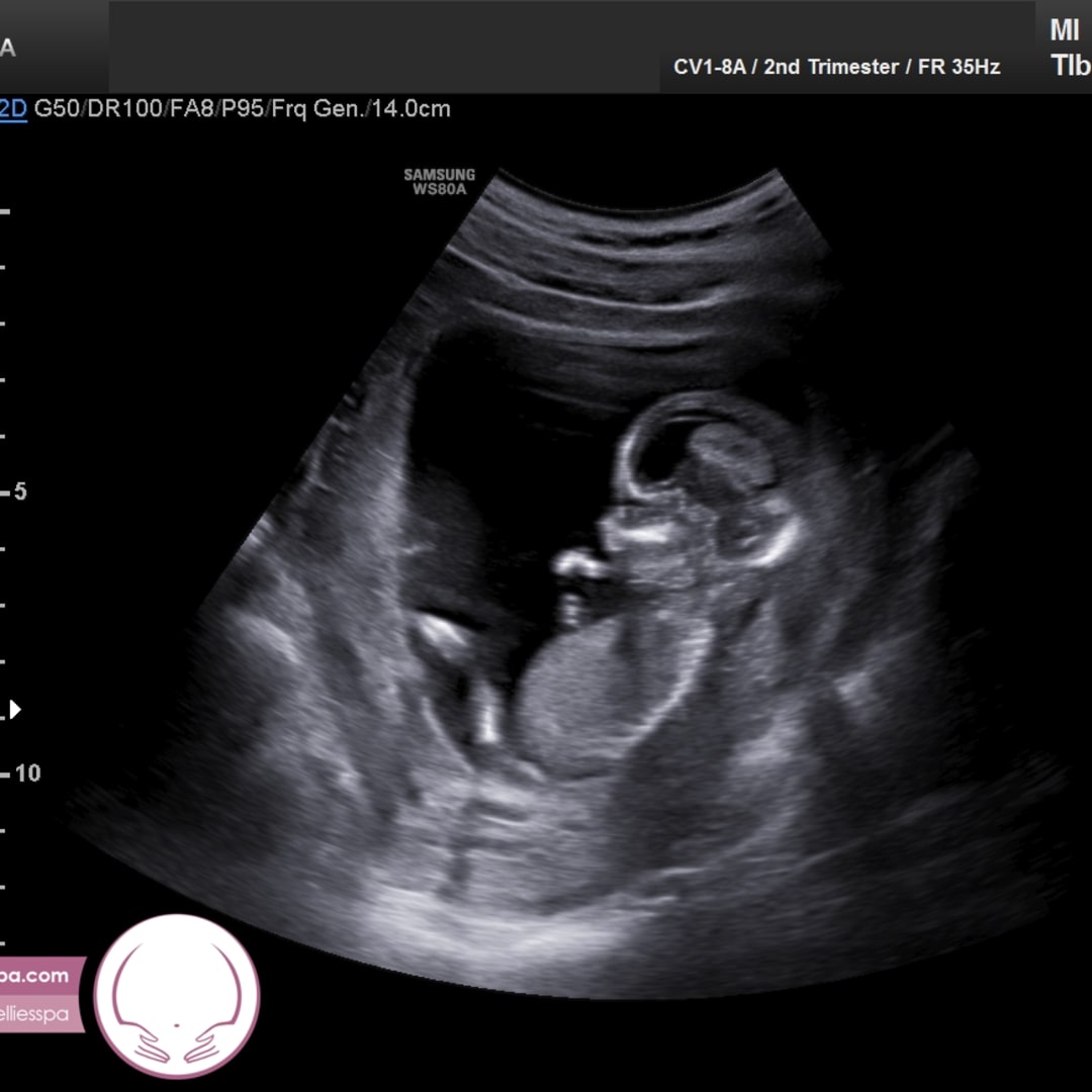 Photo shared by Brianna for their Babylist baby registry.