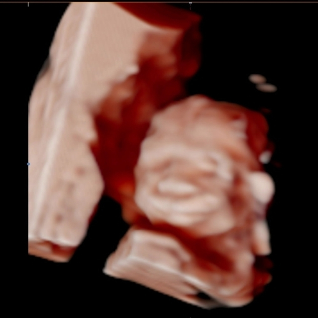 Photo shared by Hazel for their Babylist baby registry.