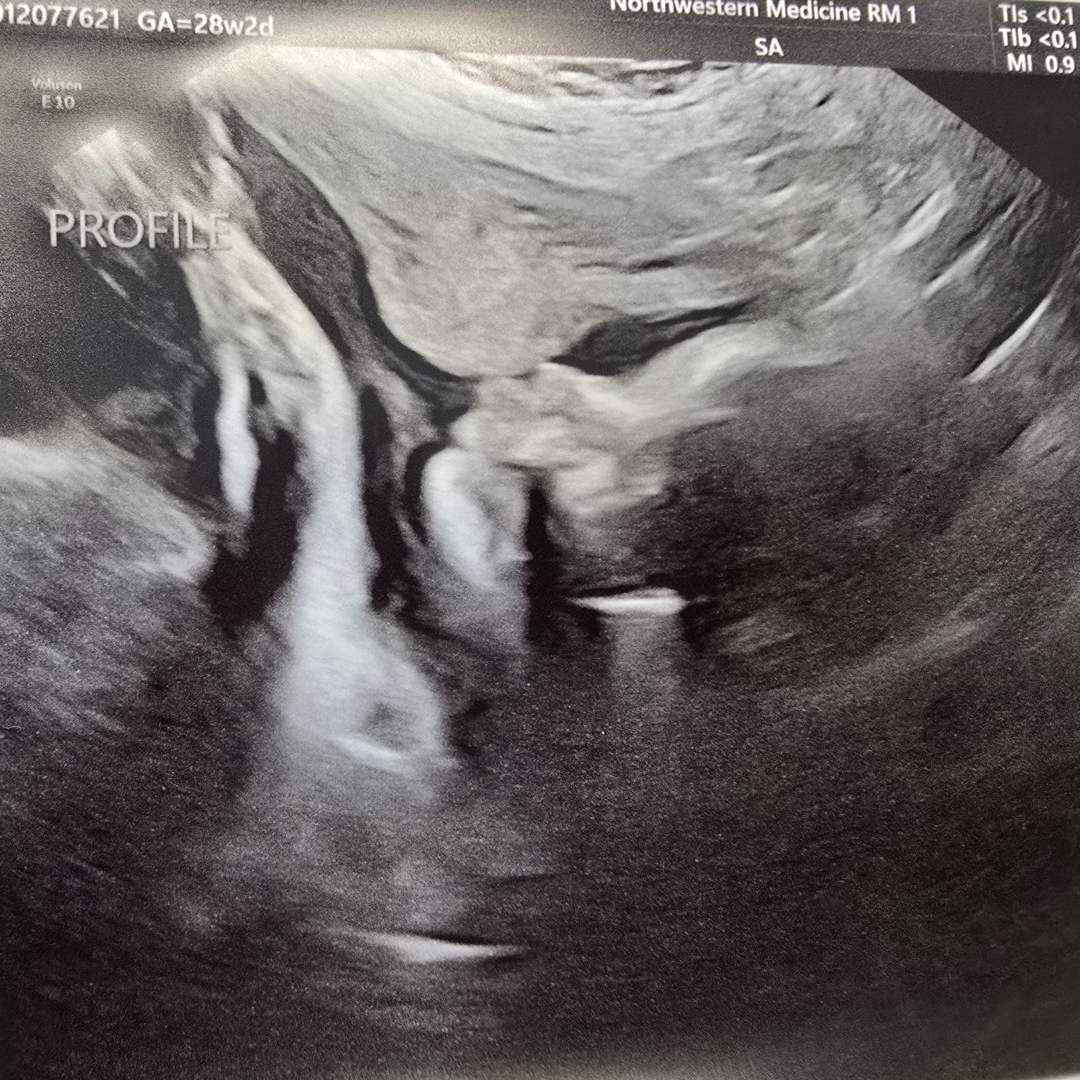 Photo shared by Kristy for their Babylist baby registry.