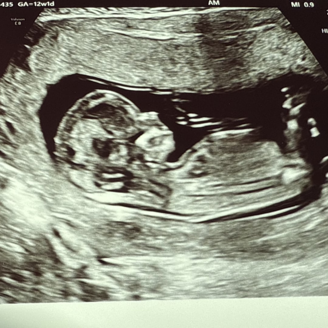 Photo shared by Julianne for their Babylist baby registry.