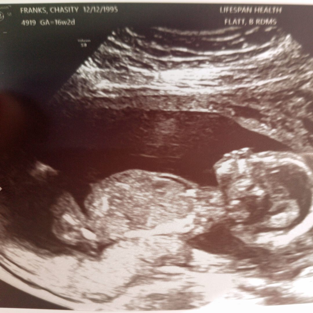 Photo shared by Chasity for their Babylist baby registry.
