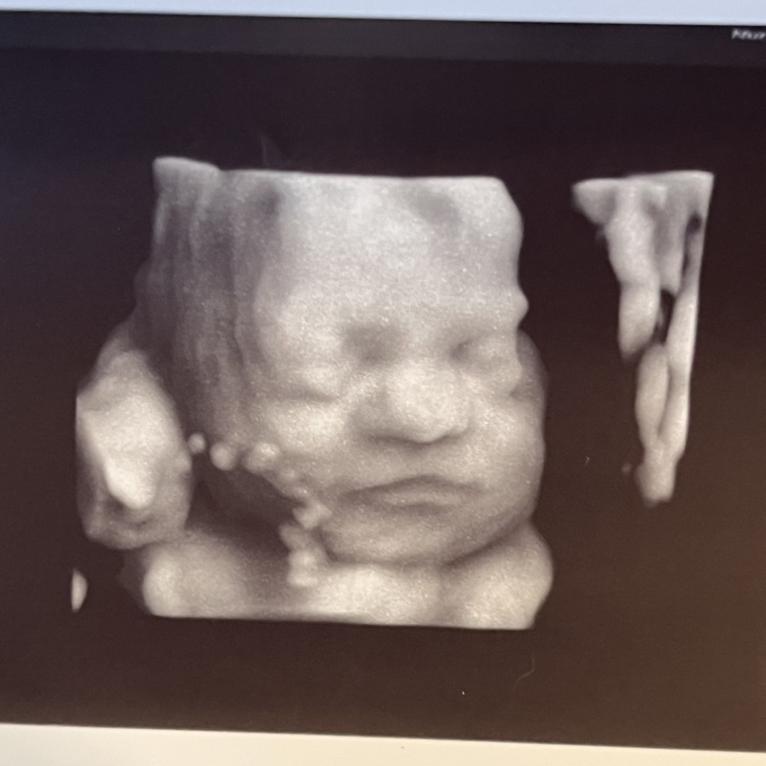 Photo shared by Allison for their Babylist baby registry.