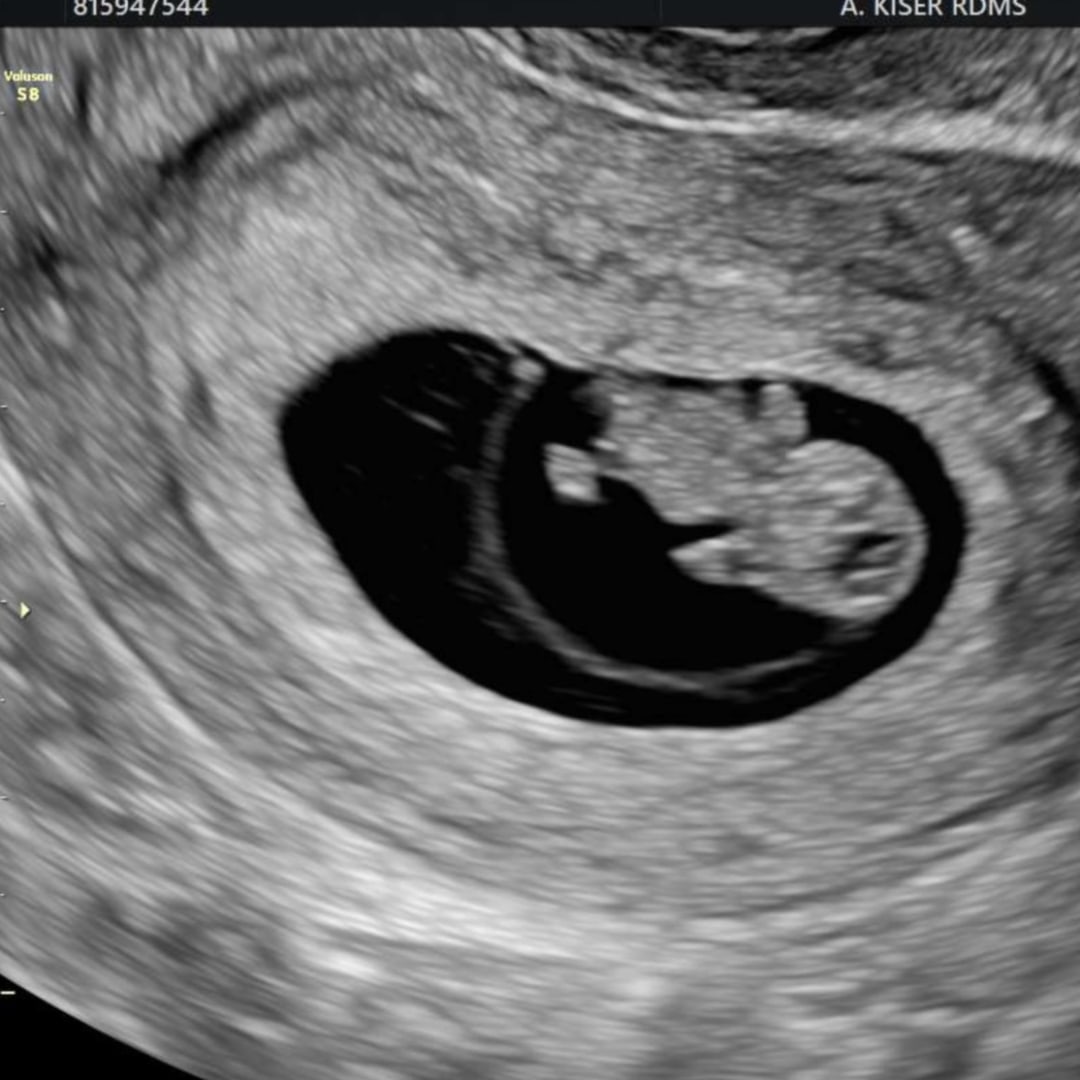 Photo shared by Makayla for their Babylist baby registry.