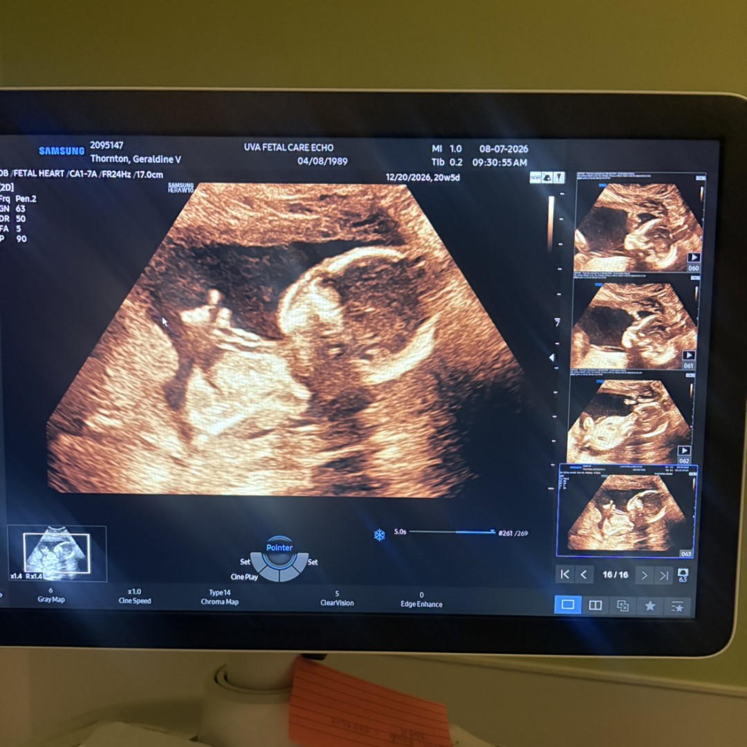 Photo shared by Geraldine for their Babylist baby registry.