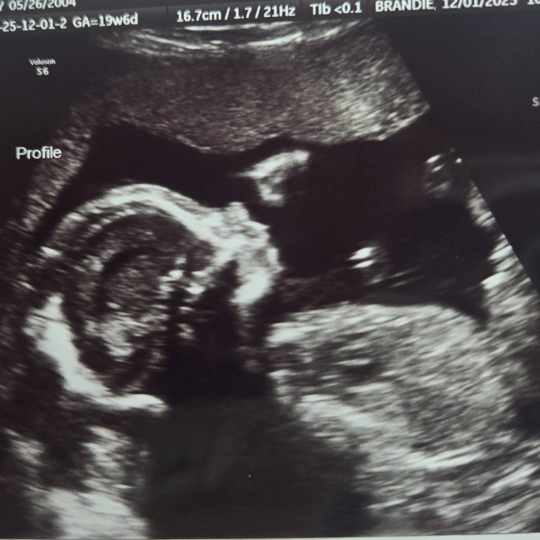 Photo shared by Katy for their Babylist baby registry.