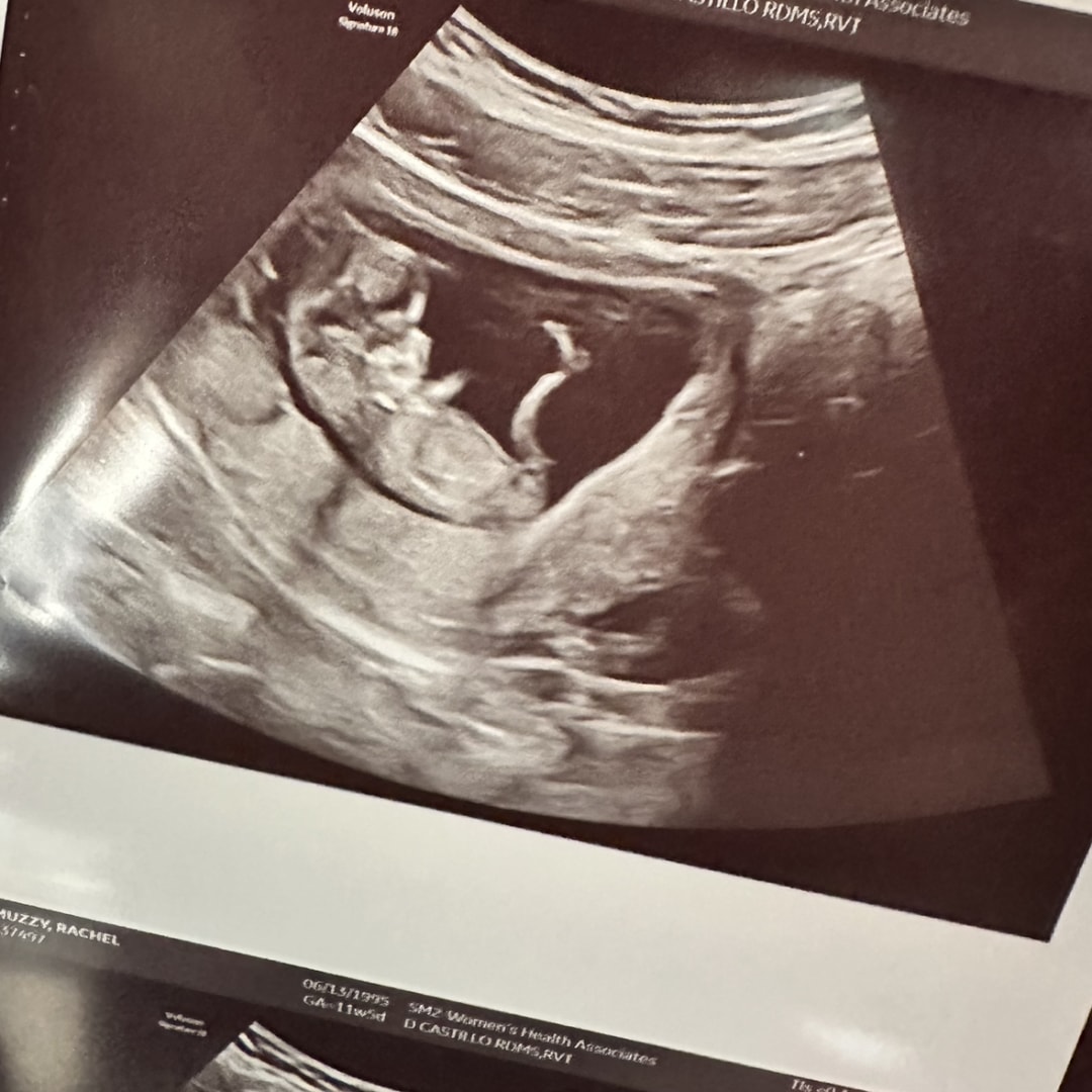 Photo shared by Rachel for their Babylist baby registry.